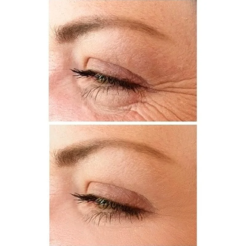 No.1 Lift Oogcrème 15 ml