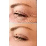 No.1 Lift Oogcrème 15 ml