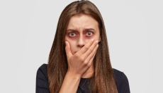 Hoe blauwe plekken te behandelen met bewezen natuurlijke methoden